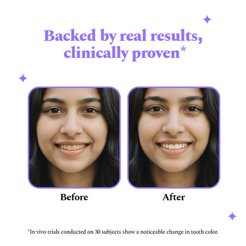 Purexa SnowWhite™ Premium Whitening Strips